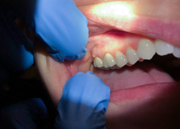 Best Emergency Dental Surgery in Prairie Village, KS